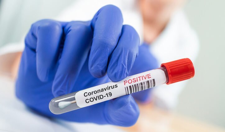 COVID-positive